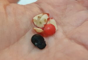 Magnolia fruit and seed Magnolia fruit and seed